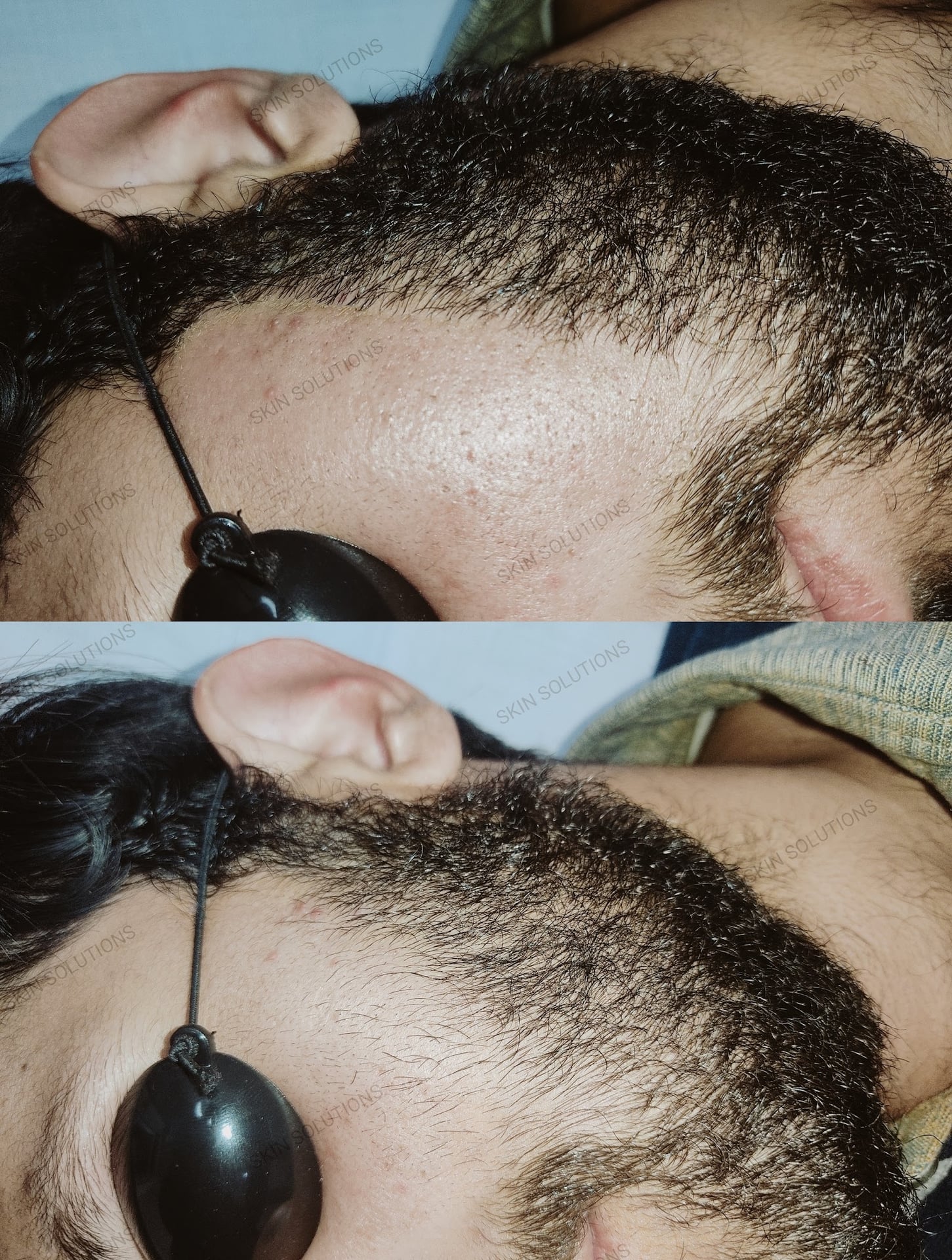 Skin Solutions & LASER centre (Dr Allauddin) photo 2