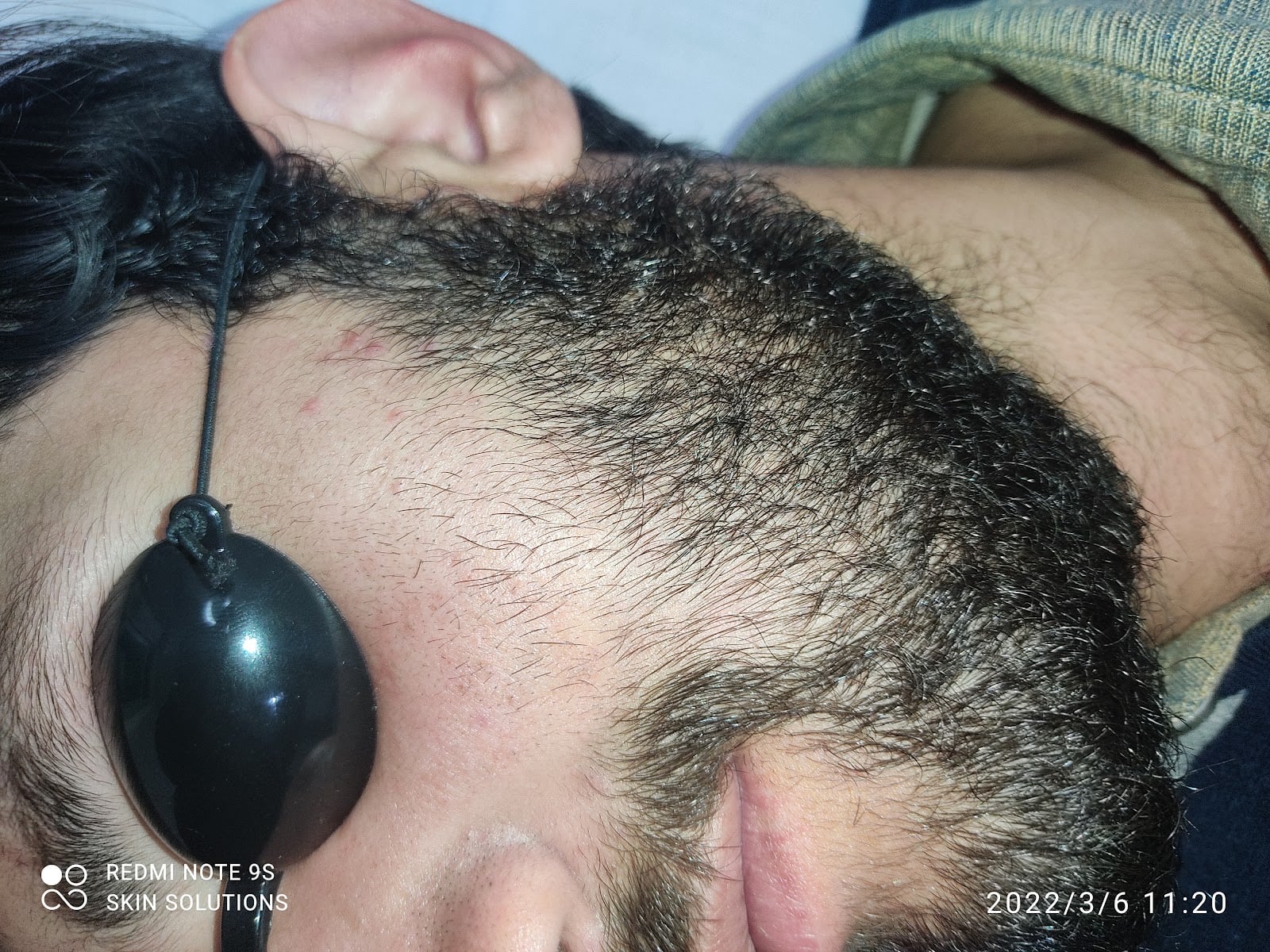 Skin Solutions & LASER centre (Dr Allauddin) photo 3